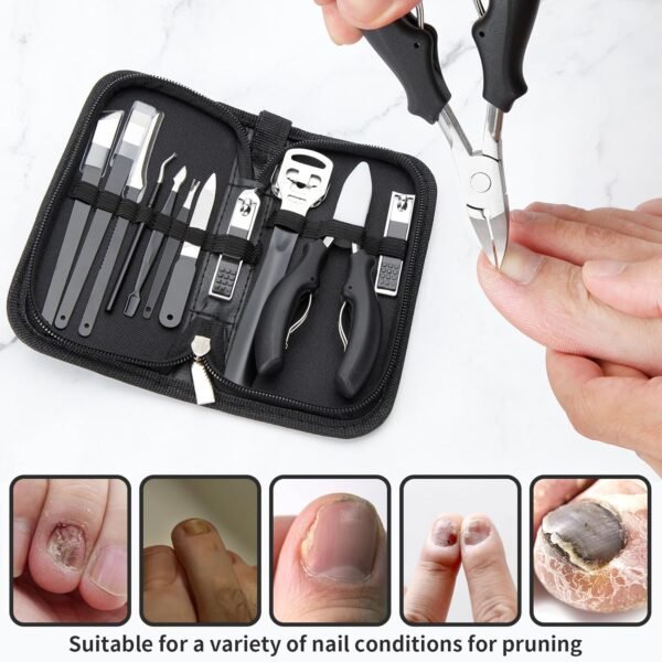 Ingrown Toenail Clippers, Upgraded - Image 3