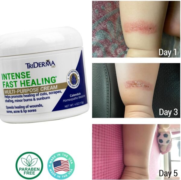 TriDerma Intense Fast Healing Cream, - Image 3
