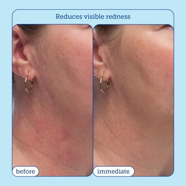 Skinfix Barrier+ Triple Lipid-Peptide - Image 4